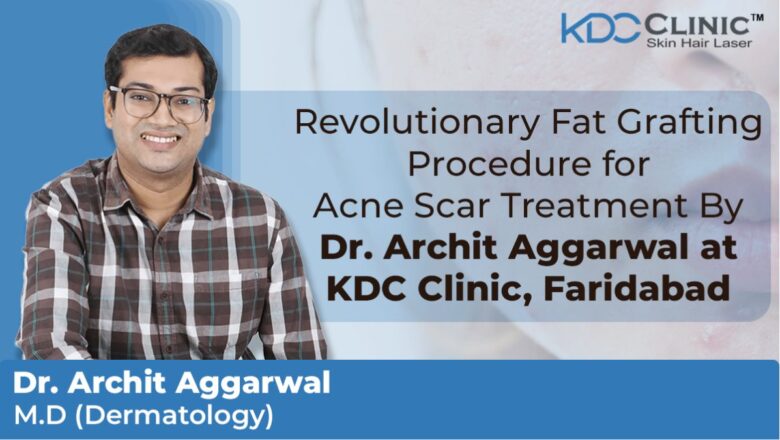 Dr. Archit Agarwal of KDC Clinic Faridabad Revolutionizes Acne Scar Treatment with Innovative Fat Grafting Procedure