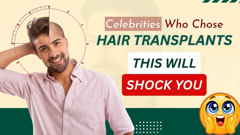 Celebrity Hair Transplant: You’d Never Guess They Had a Hair Transplant- But They Did